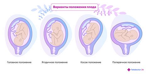 Как обеспечить головное предлежание у ребенка на каждый день?