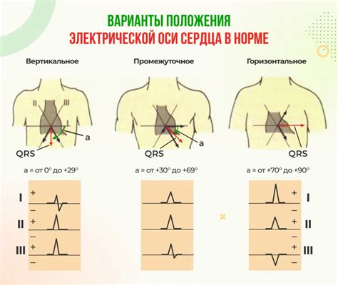 Как обнаружить отклонение ЭОС вправо