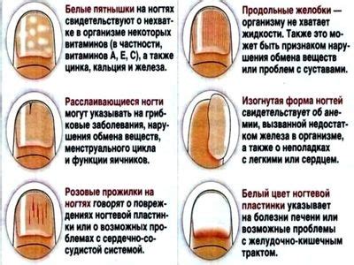 Как определить состояние здоровья по луне ногтя