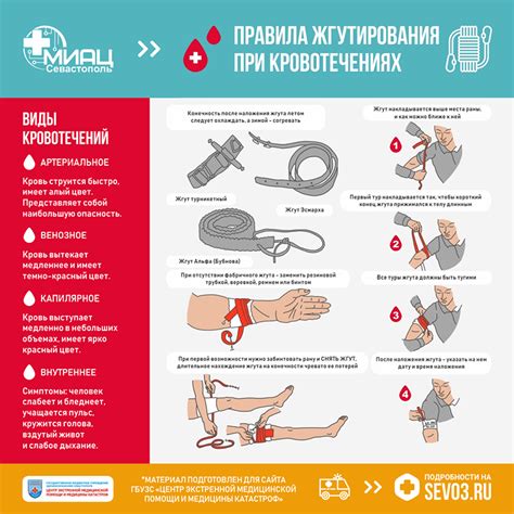 Как остановить кровотечение используя компрессию