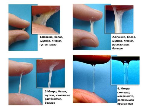 Как отличить нормальное выделение от патологического