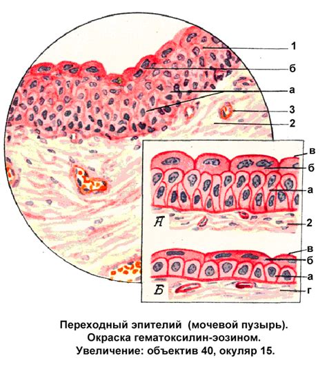 Как понять, что цилиндрический эпителий имеет реактивные изменения?