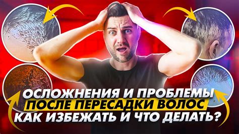 Как предотвратить возможные проблемы после пересадки?