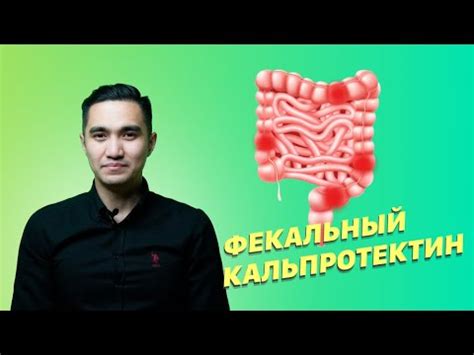 Как проводится анализ кальпротектина в кале