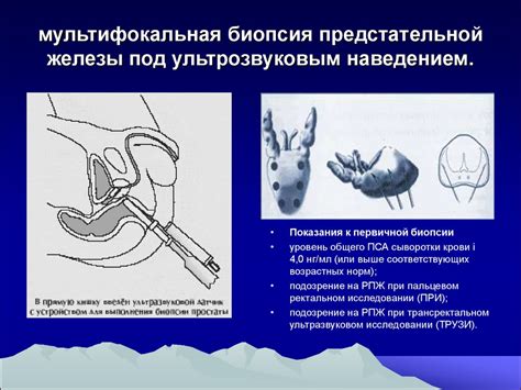 Как проводится маммограмма?