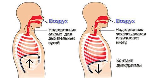 Как проявляется икота