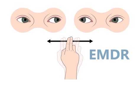 Как работает Emdr терапия?