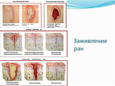 Как распознать гнойное воспаление