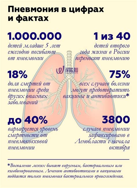 Как распознать первые признаки пневмонии у взрослых?