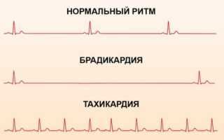 Как снизить пульс при низком давлении средствами внешней среды