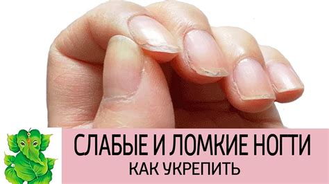 Как укрепить ломкие ногти?