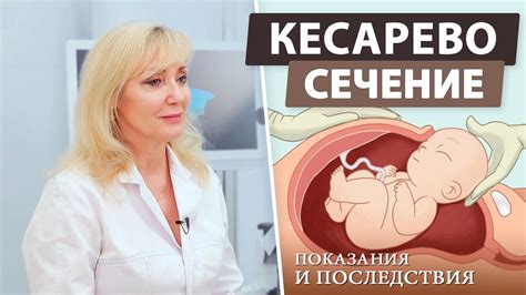 Кесарево сечение: когда и почему?