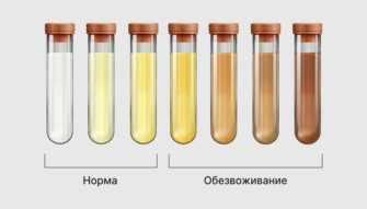 Кислая моча у женщин: причины, симптомы, лечение