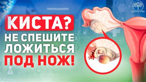 Киста яичника и ее последствия