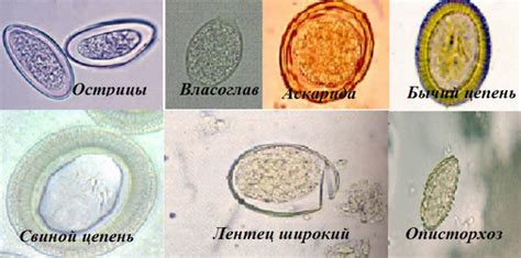 Классификация и описание различных видов глистов