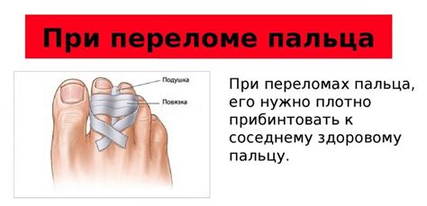 Когда нужно обратиться к врачу при переломе мизинца на ноге