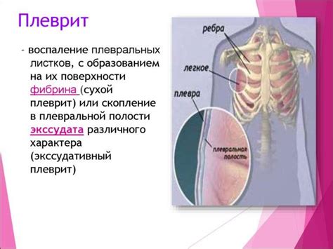 Краткое руководство по приготовлению чая для облегчения болей справа под ребром