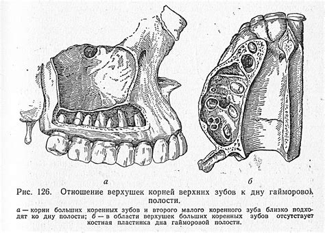 Левая верхняя челюстная пазуха и ее роль