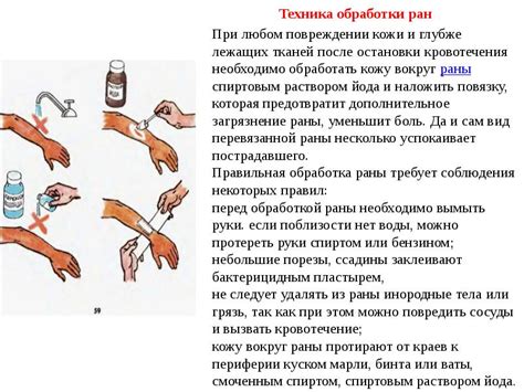 Лечение гнойной раны на пальце в домашних условиях