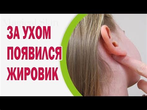 Лечение гноя в мочке уха препаратами