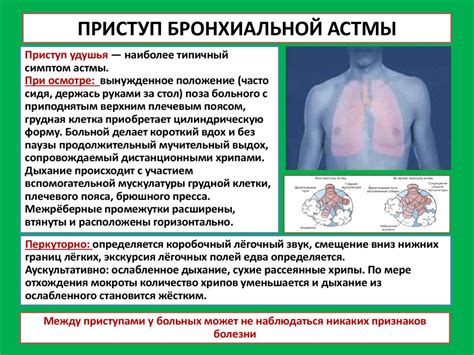 Лечение и профилактика нарушения бронхиальной проходимости