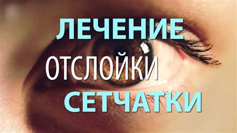 Лечение отслойки сетчатки