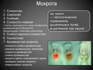 Лечение прозрачной слизи при различных заболеваниях