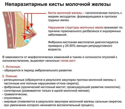 Лечение уплотнений в грудных железах