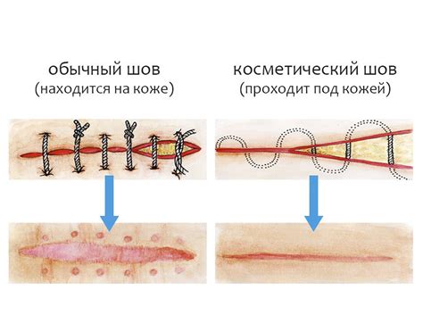 Мажут шов после операции