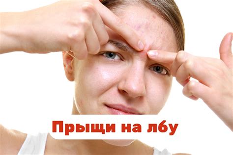 Макушка на лбу у ребенка: причины и значение