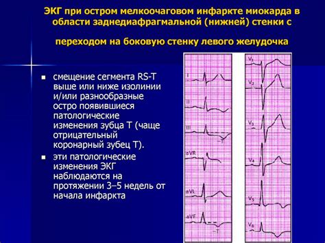 Медицинская информация о диффузных изменениях миокарда ЛЖ