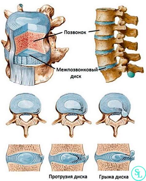 Межпозвоночный диск поясничного отдела