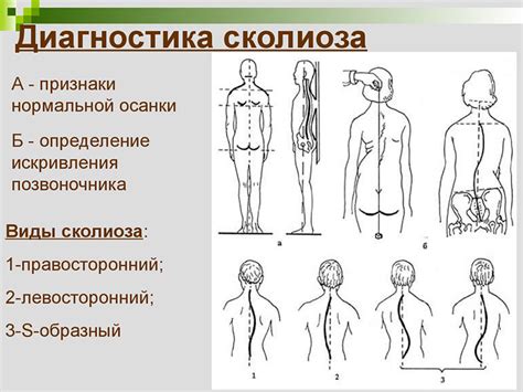 Методы коррекции смещенного позвоночника