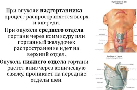 Методы лечения вибрации перепонки