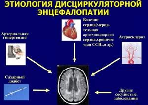 Методы лечения диагноза дэп 3 степени