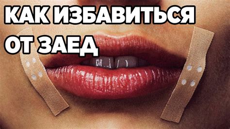 Методы лечения заедов на уголках губ