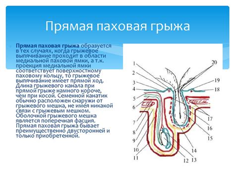 Методы лечения паховой лимфаденопатии у женщин