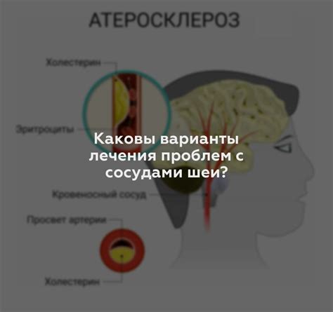 Методы лечения проблем с сосудами