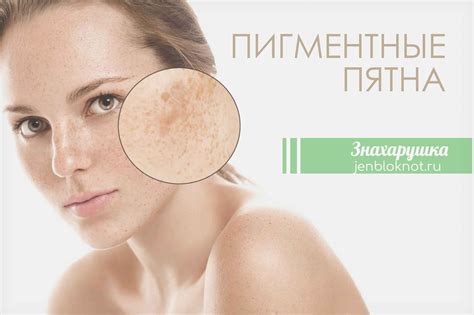 Методы лечения темно коричневых пятен на коже