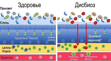 Метод 3: Использовать пробиотики