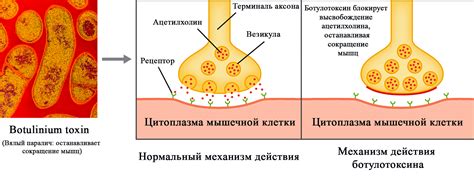 Механизм действия ботулотоксина на кожу