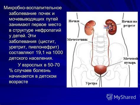 Мочеполовое заболевание у детей: влияние на мочевую систему