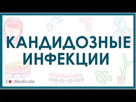 Мужчины и грибы Candida: причины, симптомы, лечение