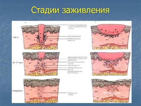 Нарушение процесса заживления послеоперационных ран