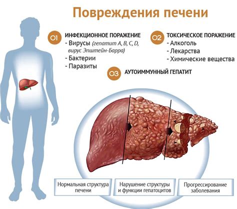 Нарушение функций печени