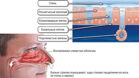 Насморк и насекомые