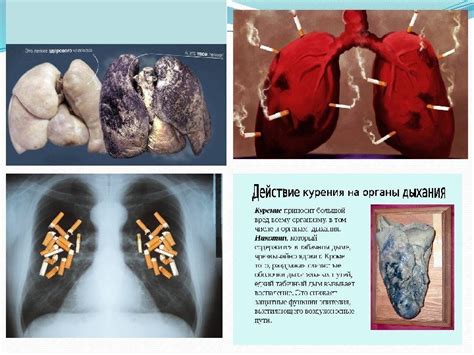 Негативное воздействие курения на организм человека