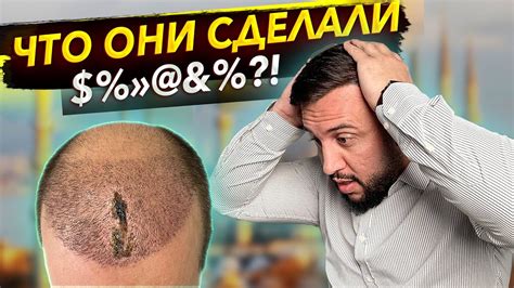 Негативные последствия отсутствия мытья волос