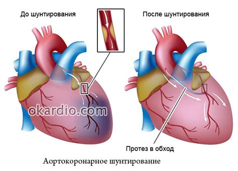 Негативный эффект на сердце и сосуды