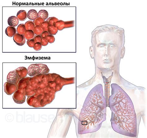 Некоторые основные причины и симптомы